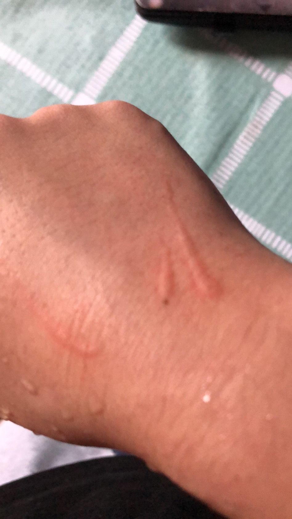 梦见被猫抓伤出血，梦见被猫抓伤出血,自己又把猫打死