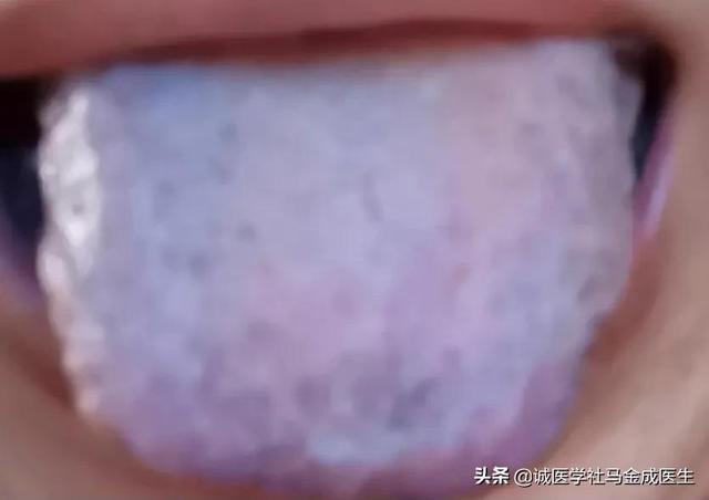 麻木通，麻木通片的功效与作用