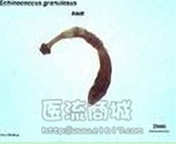 彩蚴吸虫，彩蚴吸虫取出