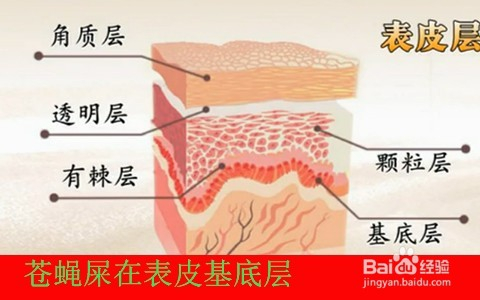 蝇子屎，蝇子屎的位置的好坏